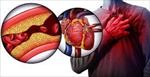 پاورپوینت-آنژین-قلبی-و-دارو-درمانی
