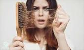 چگونه از ریزش موی سر جلوگیری کنیم